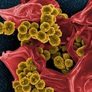 Hidden Pathways of Resistance How Environmental Fungicides Undermine Clinical Antifungals