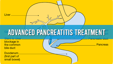 Peers Alley Media: Advanced Pancreatitis Treatment