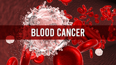 Peers Alley Media: Blood Cancer
