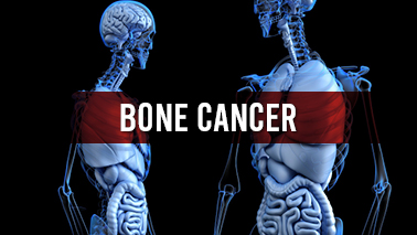 Peers Alley Media: Bone Cancer