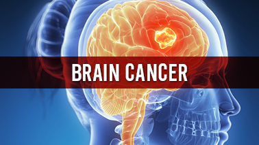 Peers Alley Media: Brain Cancer