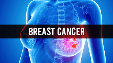 Peers Alley Media: Breast Cancer