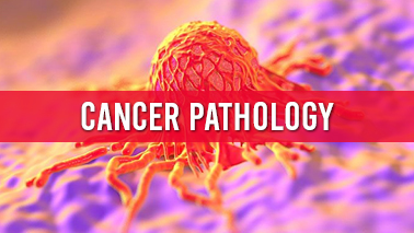 Peers Alley Media: Cancer Pathology