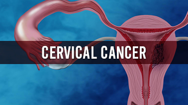 Peers Alley Media: Cervical Cancer