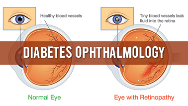 Peers Alley Media: Diabetes Ophthalmology