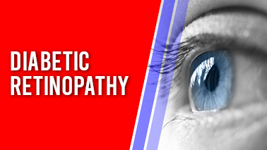 Peers Alley Media: Diabetic Retinopathy