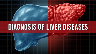 Peers Alley Media: Diagnosis of Liver Diseases