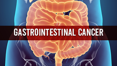 Peers Alley Media: Gastrointestinal Cancer