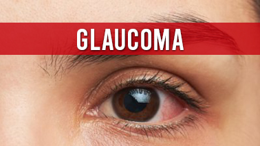 Peers Alley Media: Glaucoma