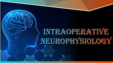 Peers Alley Media: Intraoperative Neurophysiology 