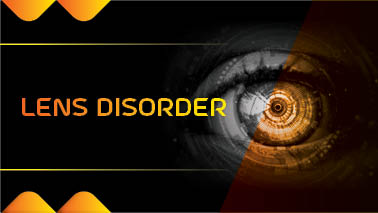 Peers Alley Media: Lens Disorder