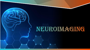 Peers Alley Media: Neuroimaging