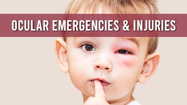 Peers Alley Media: Ocular Emergencies  Injuries