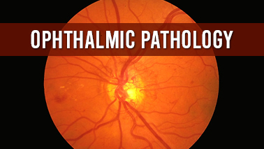 Peers Alley Media: Ophthalmic Pathology
