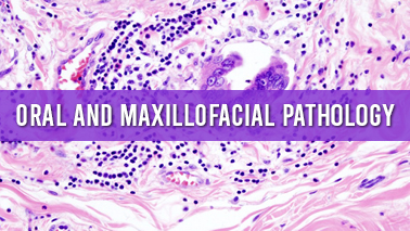 Peers Alley Media: Oral and Maxillofacial  Pathology
