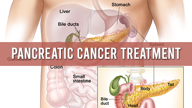Peers Alley Media: Pancreatic Cancer Treatment