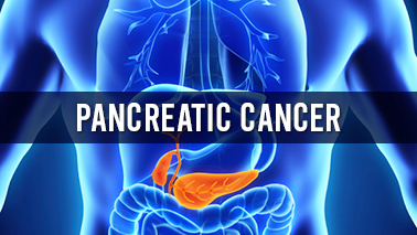 Peers Alley Media: Pancreatic Cancer