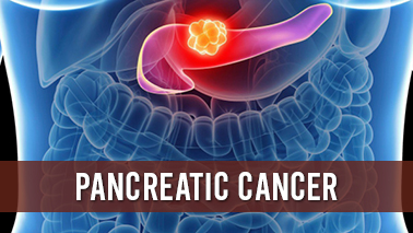 Peers Alley Media: Pancreatic Cancer
