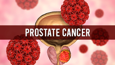 Peers Alley Media: Prostate Cancer