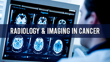 Peers Alley Media: Radiology and Imaging in Cancer