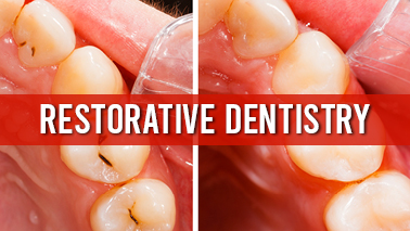 Peers Alley Media: Restorative Dentistry