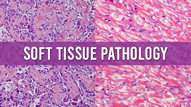 Peers Alley Media: Soft Tissue Pathology