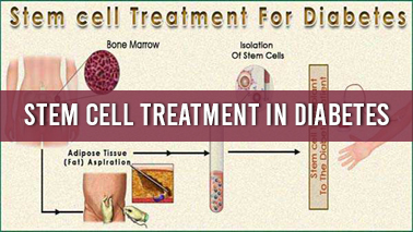 Peers Alley Media: Stem Cell treatment in Diabetes