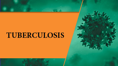 Peers Alley Media: Tuberculosis