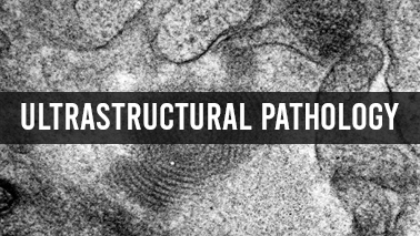 Peers Alley Media: Ultra Structural Pathology