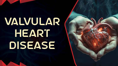 Peers Alley Media: Valvular Heart Disease